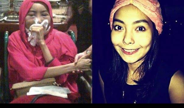 Kenali Penyebab Kanker Lidah yang Sebabkan Artis FTV Cecilia Putty